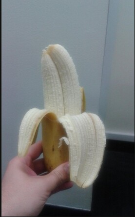 网友分享双子香蕉照片 剥皮后发现双果肉